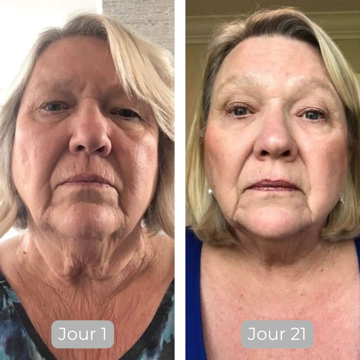 Luminate Ansigtsserum med C-Vitamin