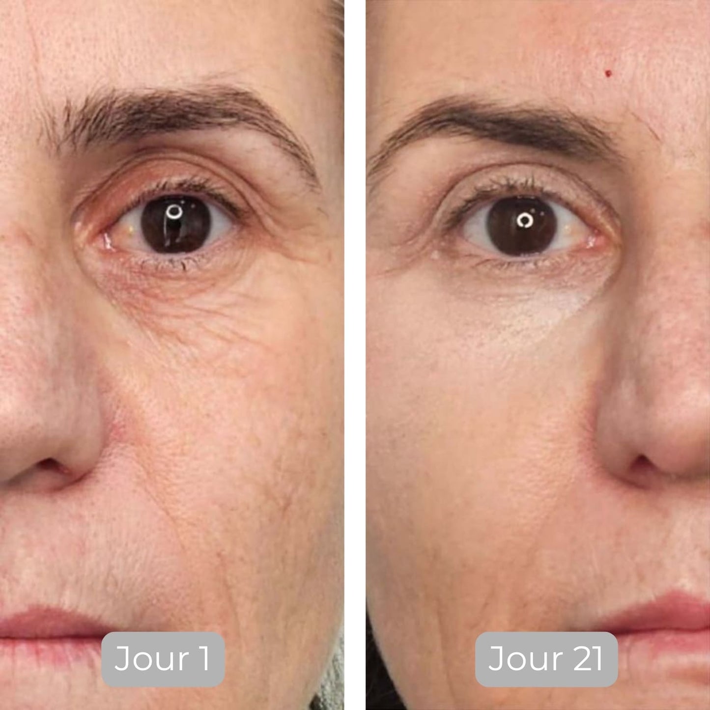 Luminate Ansigtsserum med C-Vitamin