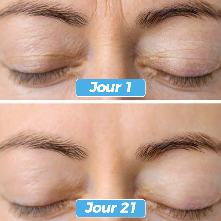 Glowskin Pro2 - LED Maske til Ansigts- og Halsbehandling