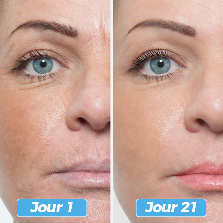 Glowskin Pro2 - LED Maske til Ansigts- og Halsbehandling