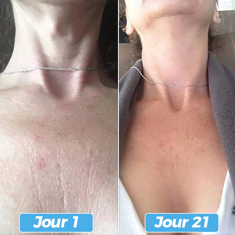 Glowskin Pro2 - LED Maske til Ansigts- og Halsbehandling