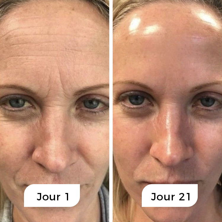 Rejuven - Anti-Age Natserum