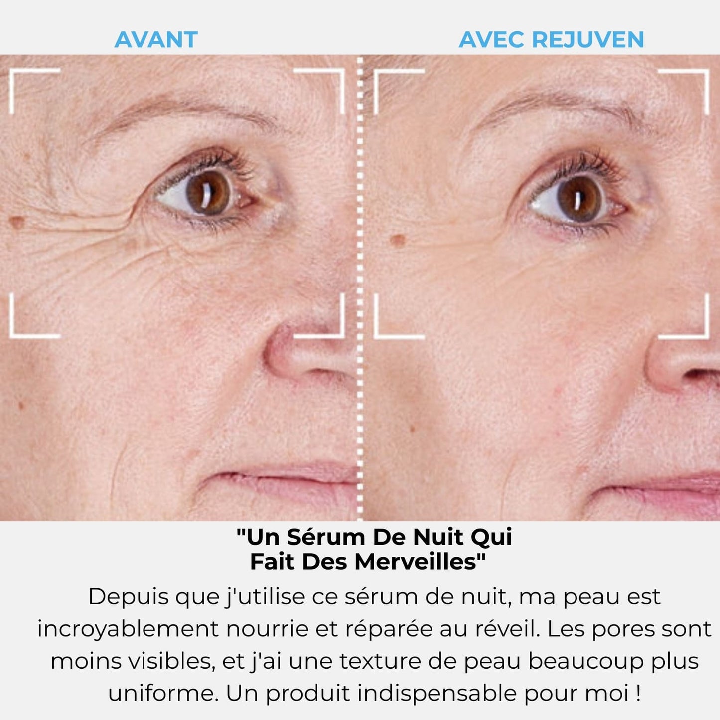 Rejuven Abonnement