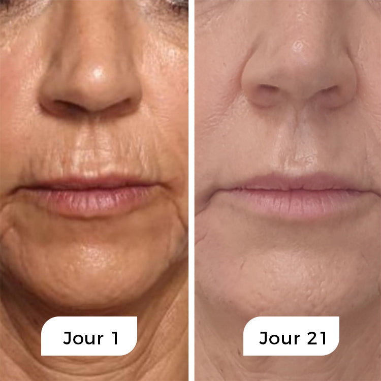 Rejuven - Anti-Age Natserum