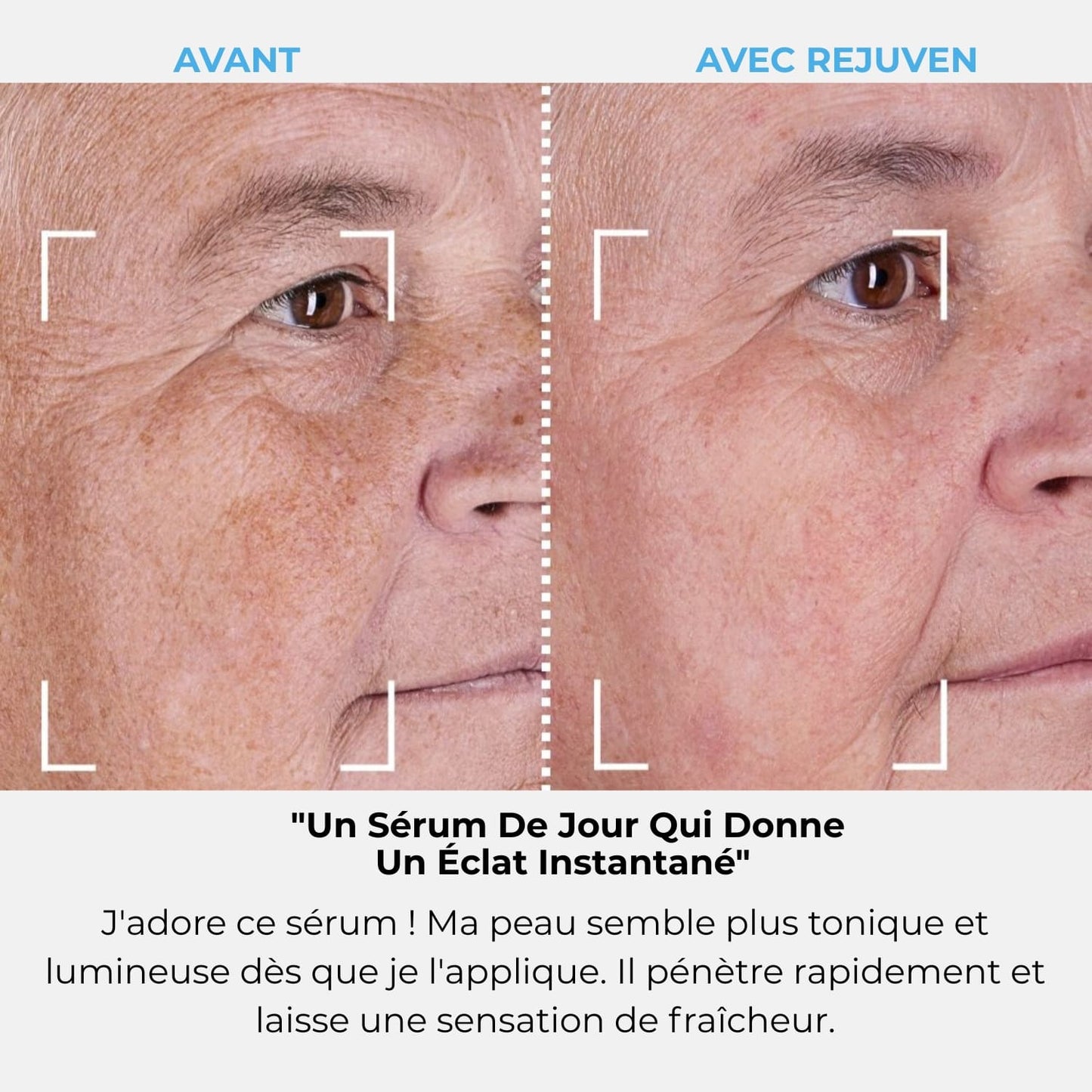 Rejuven Abonnement