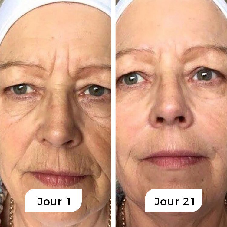 Rejuven - Anti-Age Natserum