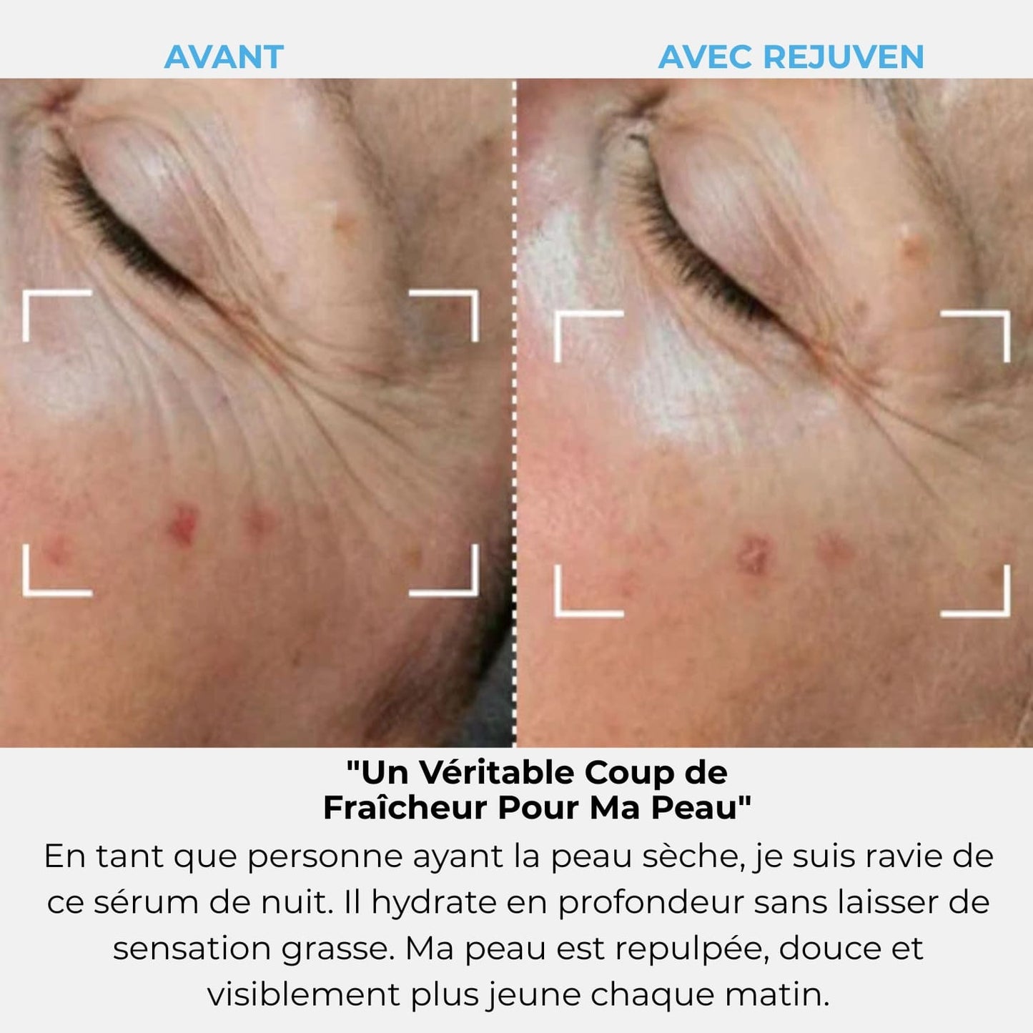 Rejuven Abonnement